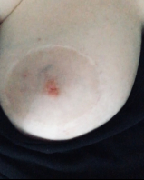 Bbw slut with big saggy tits